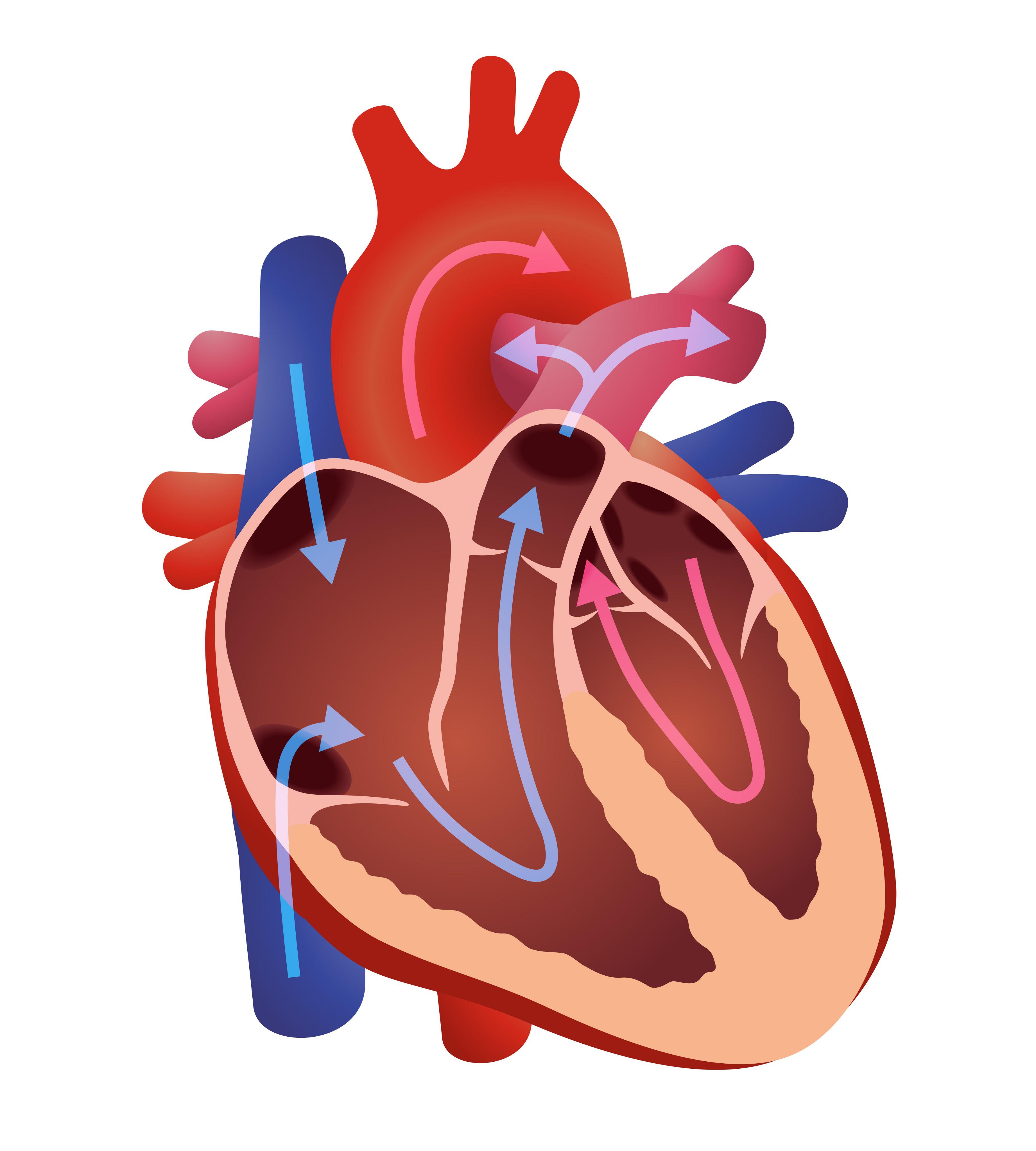 Valvular Heart Disease
